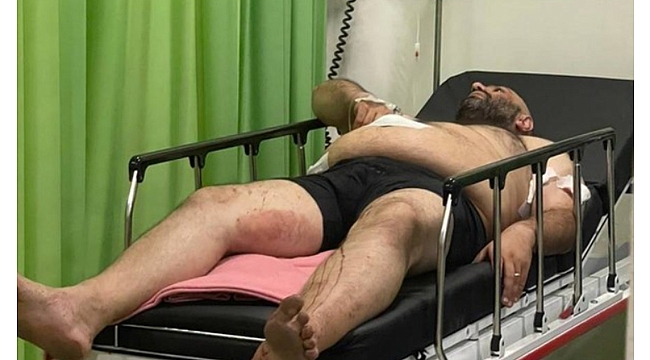 Mehmet Turan Bali'de kaldığı villada saldırıya uğradı...