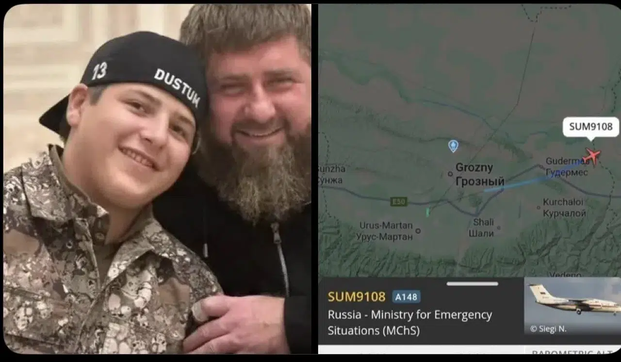 RAMZAN KADİROV'UN OĞLU TRAFİK KAZASINDA KOMAYA GİRDİ!